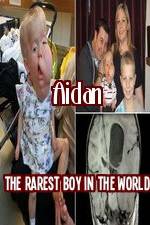 Watch Aidan The Rarest Boy In The World Nowvideo