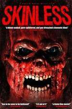Watch Skinless Nowvideo