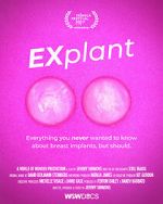 Watch Explant Nowvideo