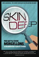 Watch Skin Deep: The Battle Over Morgellons Nowvideo