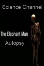 Watch Science Channel Elephant Man Autopsy Nowvideo
