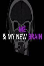 Watch Me & My New Brain Nowvideo