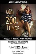 Watch The Man With The 200lb Tumor Nowvideo