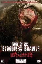 Watch TNA Wrestling: Best of the Bloodiest Brawls - Scars and Stitches Nowvideo