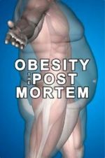 Watch Obesity: The Post Mortem Nowvideo