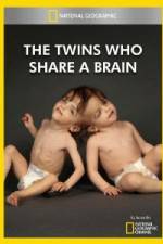 Watch National Geographic The Twins Who Share A Brain Nowvideo