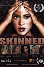 Watch Skinned Nowvideo