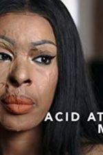 Watch Acid Attack: My Story Nowvideo