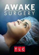 Watch Awake Surgery Nowvideo